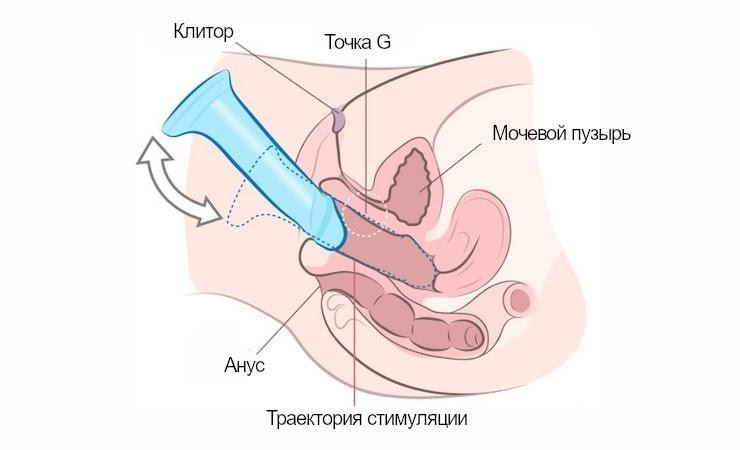 раскачка